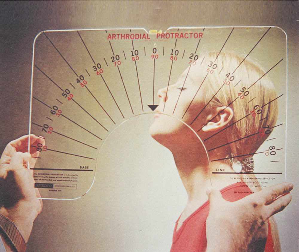 Arthrodial Protractor