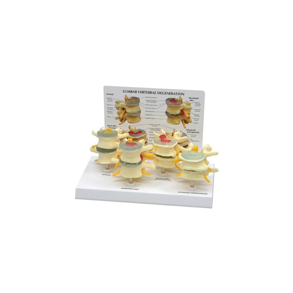 GPI Anatomicals® 4-Stage Vertebrae